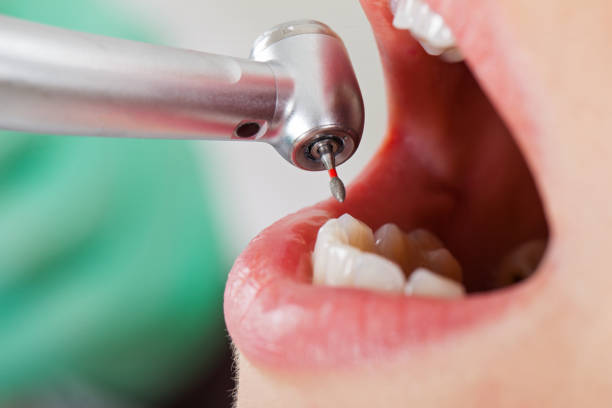 Best Emergency Treatment for Toothache in West Brownsville, PA